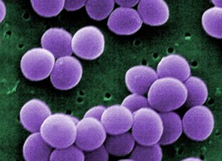 The Virus Testing Boom is Upon Us (CODX, DGX, RXMD, LH)