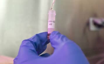 Pulmatrix Inc. (NASDAQ:PULM) Partners with Sensory Cloud under a License Agreement for Marketing and Distribution of NasoCalm