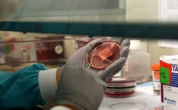 Bluebird bio Inc. (NASDAQ:BLUE) Releases Q3 Results and Announces BLA submission For LentiGlobin™ In SCD