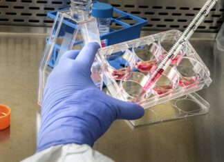 Amicus Therapeutics (NASDAQ:FOLD) Commences Rolling BLA For AT-GAA In Treatment Of Late-Onset Pompe Disease